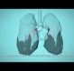 Respira la Vida – Cómo la contaminación del aire afecta a tu cuerpo